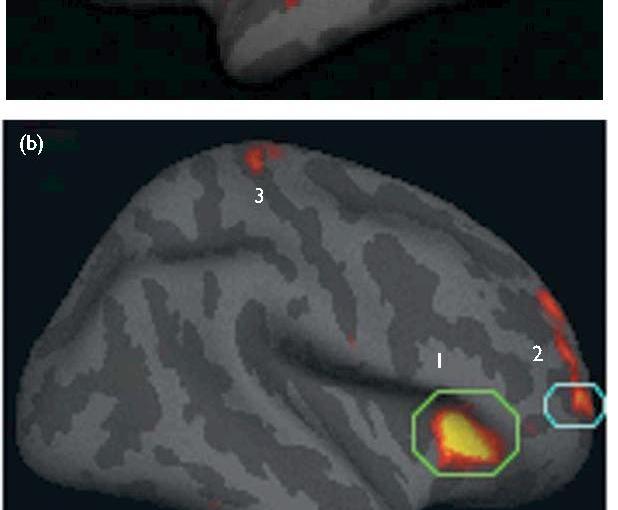 How mindfulness changes the structure of your&nbsp;brain