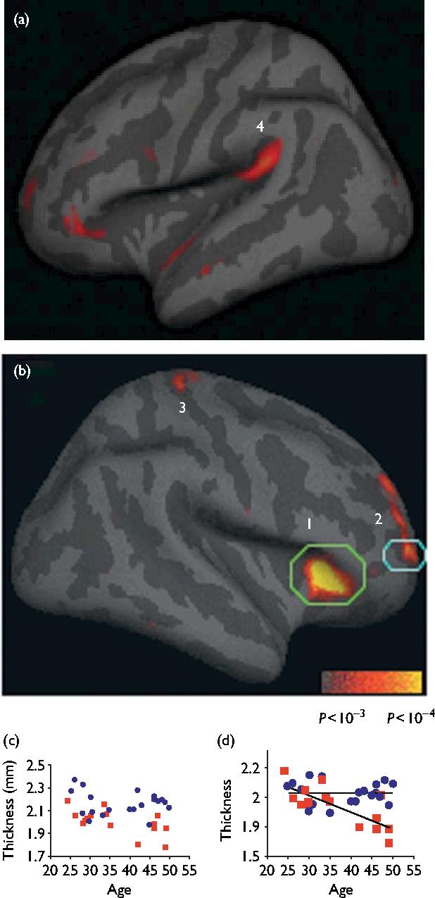 how mindfulness changes the structure of your brain